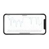 Milian légzésfigyelõ Lite Bluetooth 2db érzékelõlappal
